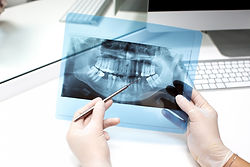 Radiografia panoramica realizzata presso Nuovo Centro Medico Euganeo Studio dentistico a Battaglia Terme