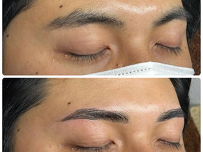 HBL【before/after】