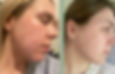 skin2_edited.jpg