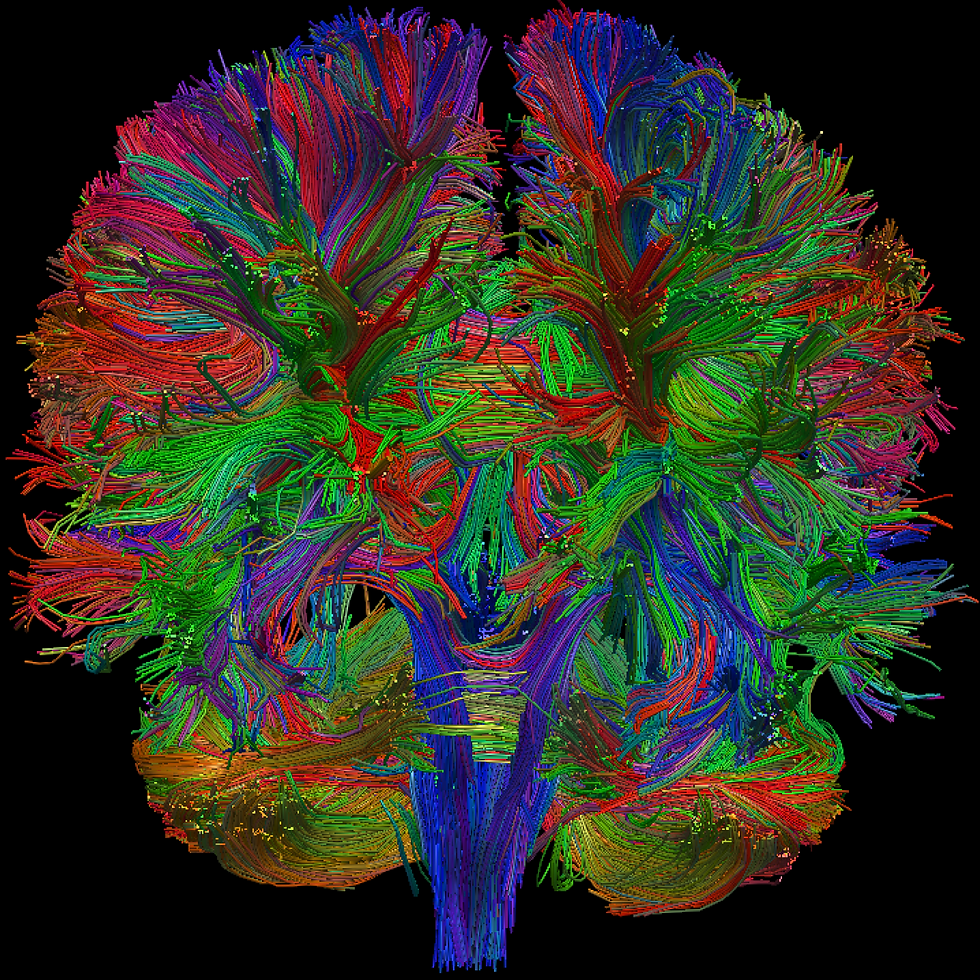 Multicolored brain showing millions of neuron connections