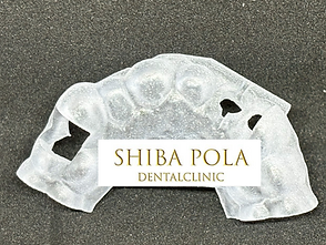 サージカルガイド|芝ポーラ歯科|芝公園・三田・田町・赤羽橋の歯医者