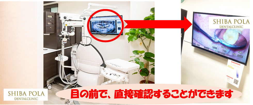 マイクロスコープ、画面で見れる|港区芝公園・赤羽橋・三田・田町の歯医者|芝ポーラ歯科