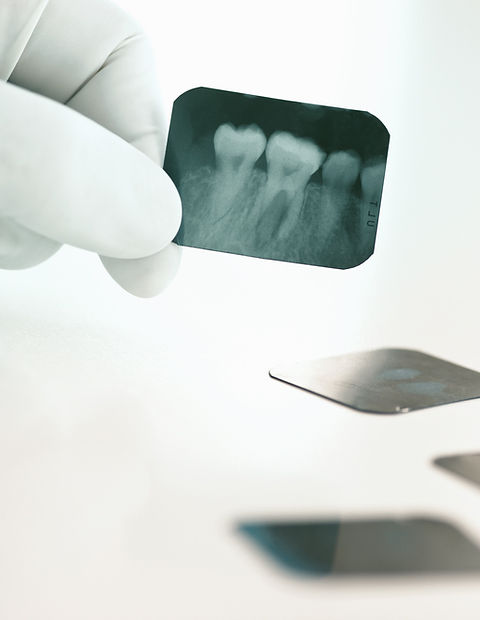 Radiografia_odontologica.jpg