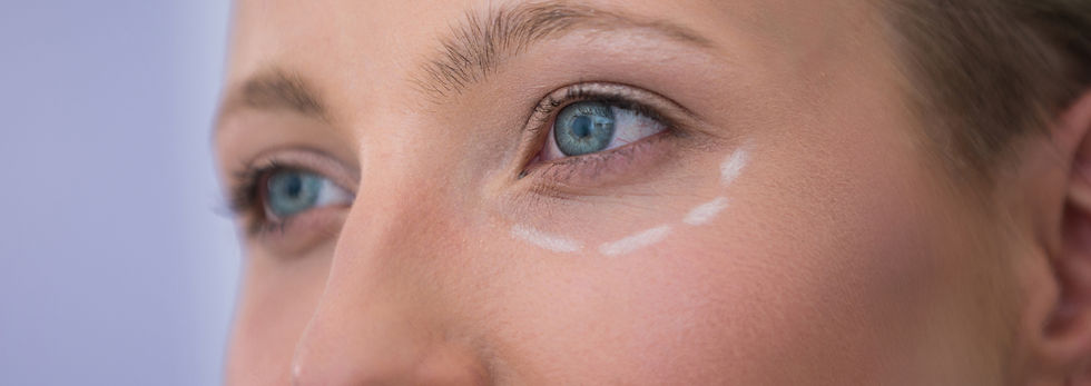 woman-with-marks-drawn-cosmetic-treatment.jpeg