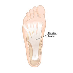 plantar_fascia.jpg