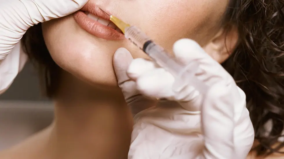 lip-filler (1).webp