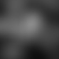 “SURU” by Kepa Lehtinen