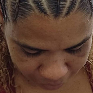 Pomada para cabelos provoca cegueira