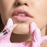 Juvederm Lip and Dermal Filler Treatments at Fortress Medical Aesthetics