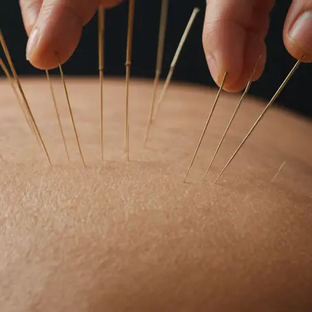 The Healing Power of Acupuncture: Ancient Wisdom for Managing Chronic Pain