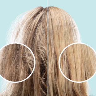 woman from the back. one side has hair with protein overload and the other normal, balanced hair. Two circles showing closeup of the hair.