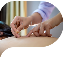 acupuncture.png