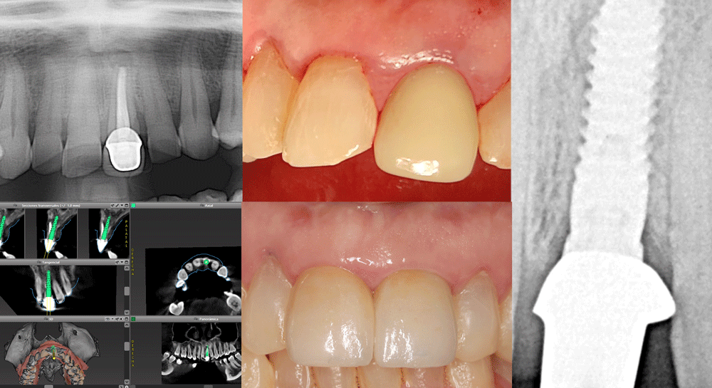 CARILLA-DENTAL.gif