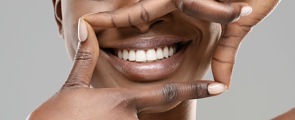 Perfect Smile