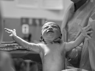 A newborn baby stretches its arms out wide as it is held up by a person in a surgical gown