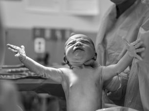 A newborn baby stretches its arms out wide as it is held up by a person in a surgical gown