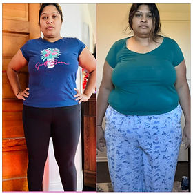tirzepatide fda approval Zepbound vs Tirzepatide: Differences, Cost & Weight Loss Results