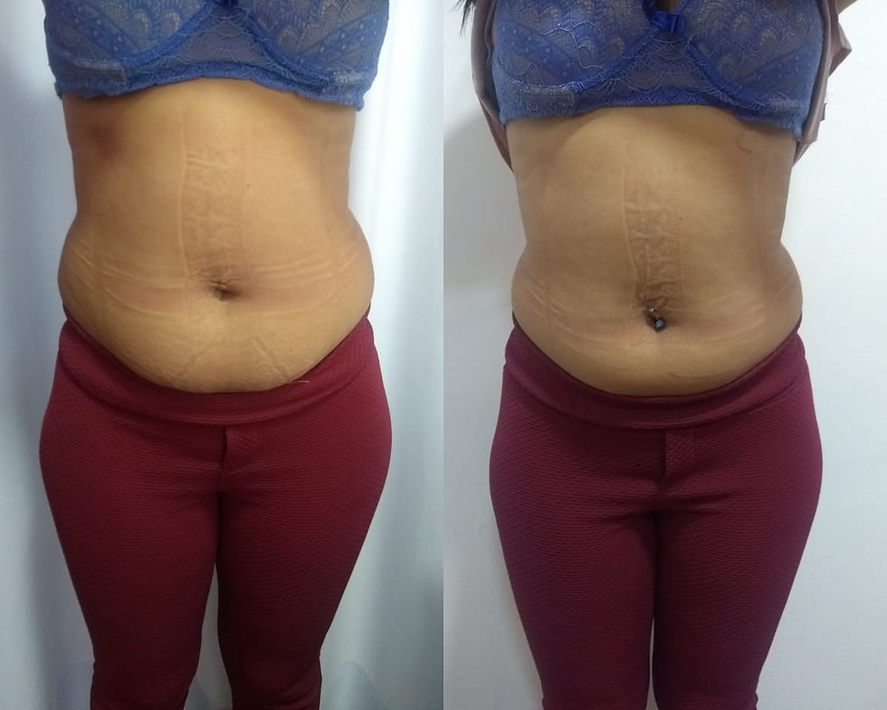 Miniatura: Lipo Detox-Gessada