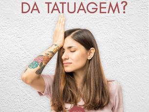 Remoção de tatuagem a laser