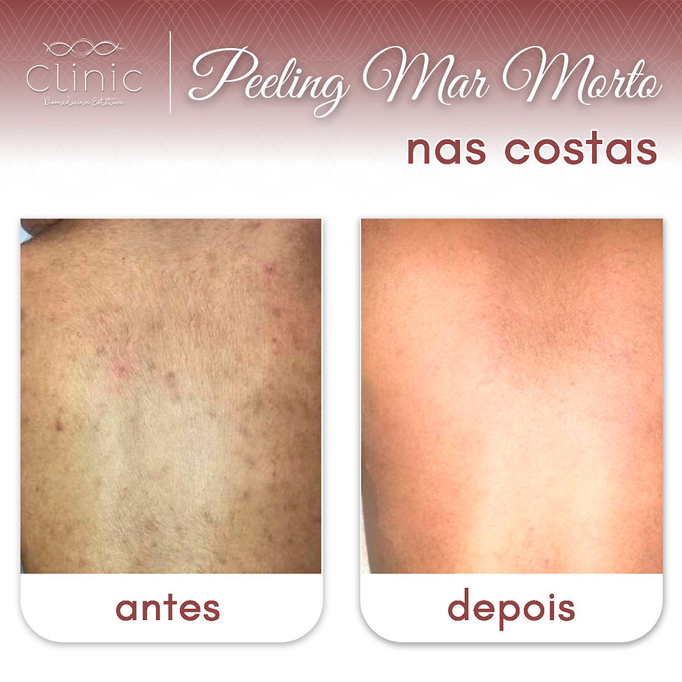Miniatura: Peeling do Mar Morto