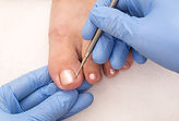 Toe nail cutting and management.