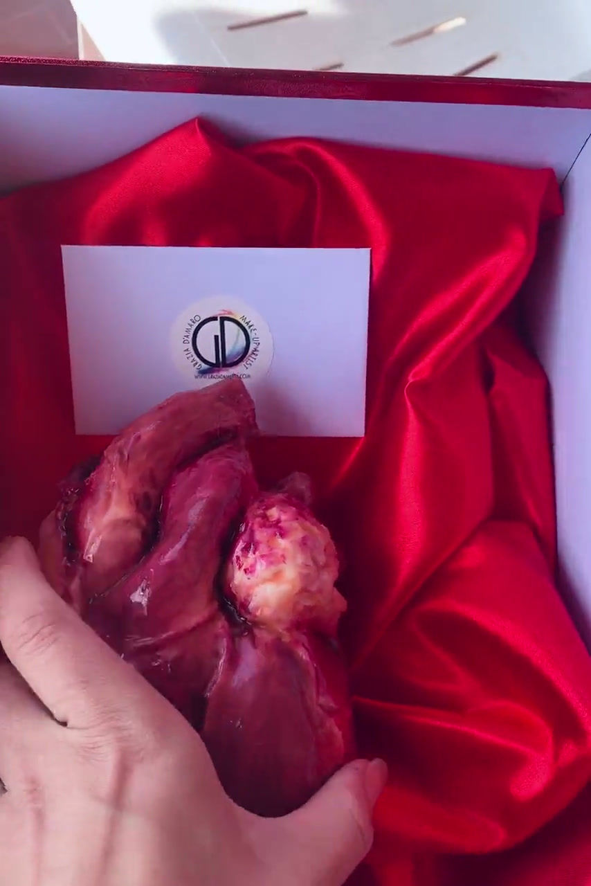 Thumbnail: Cuore Umano - Riproduzione Anatomica 1:1