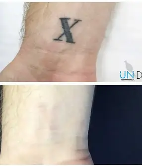undocase2.jpg.webp
