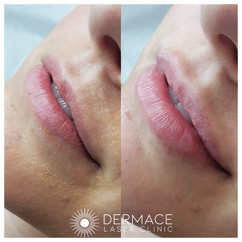 lips-4