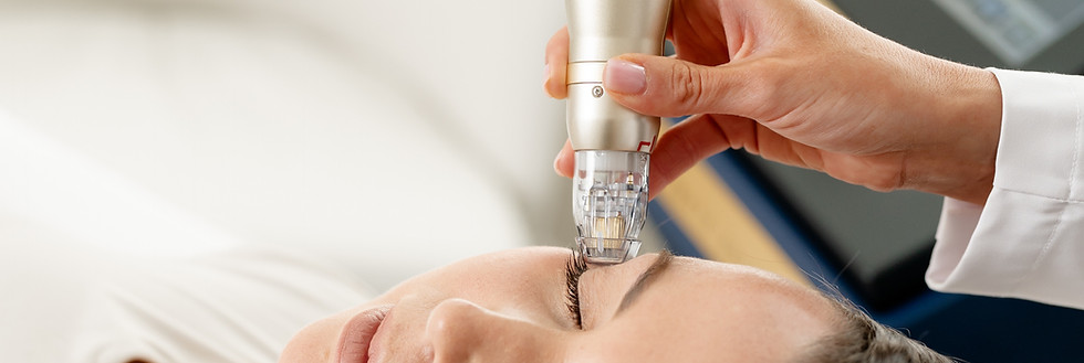 eyelid-tightening.JPG
