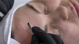 Dermaplaning in Lubbock: Exfoliation for Dry, Sun-Damaged Skin