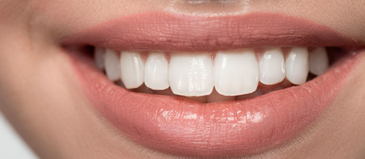 O Poder do Sorriso: o poder da auto-estima