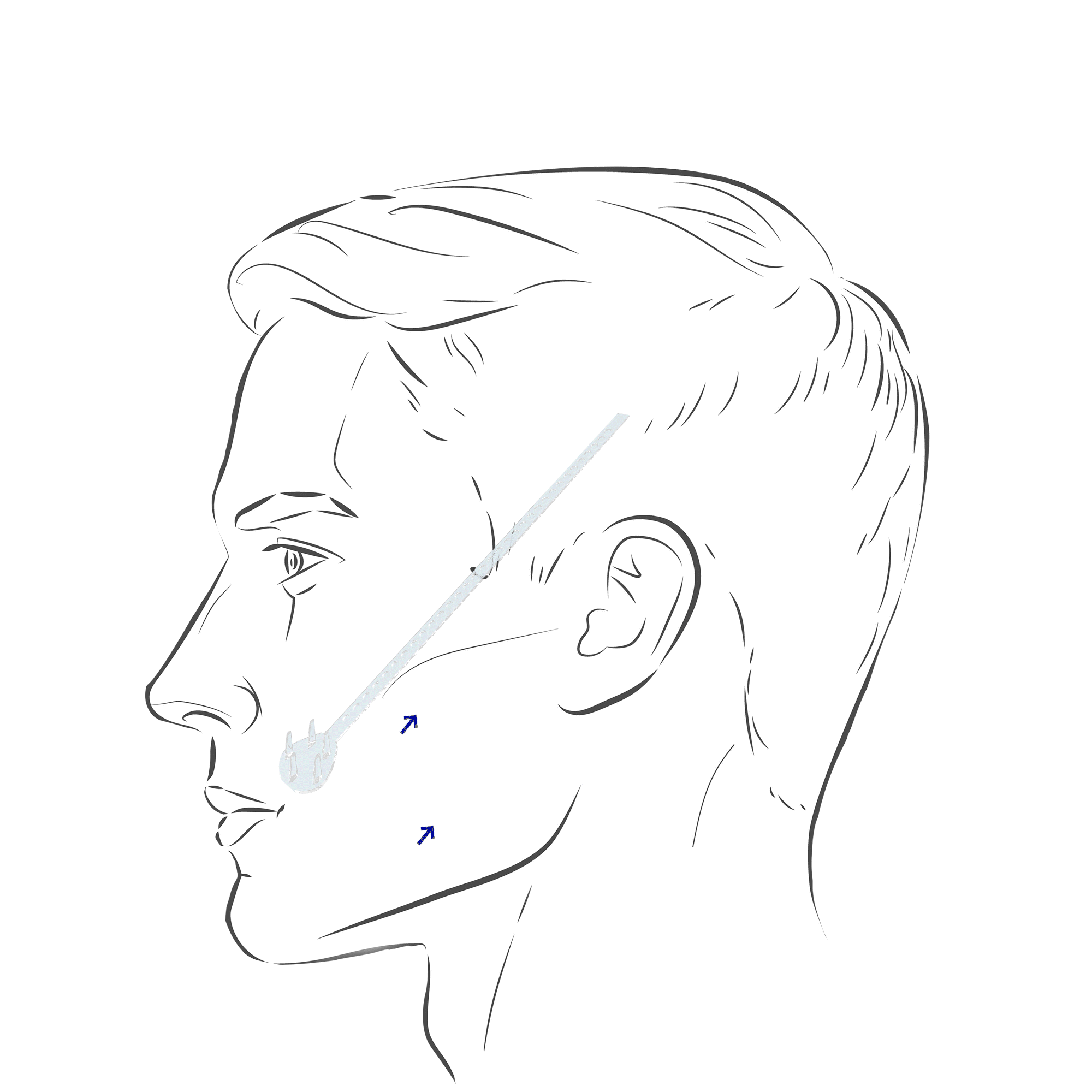 Midface.gif
