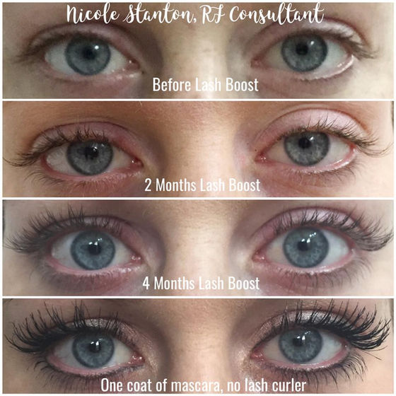 Lash Boost Giveaway!