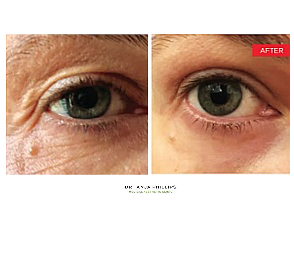 Smootheye-1024x1024.jpg