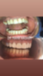 Crown replacements