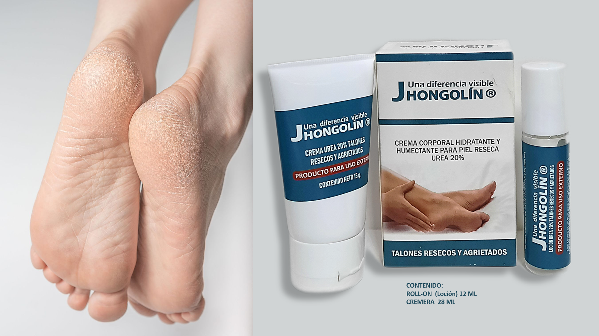 CREMA TALONES RESECOS AGRIETADOS UREA 20%