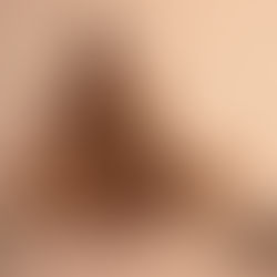 NVMI