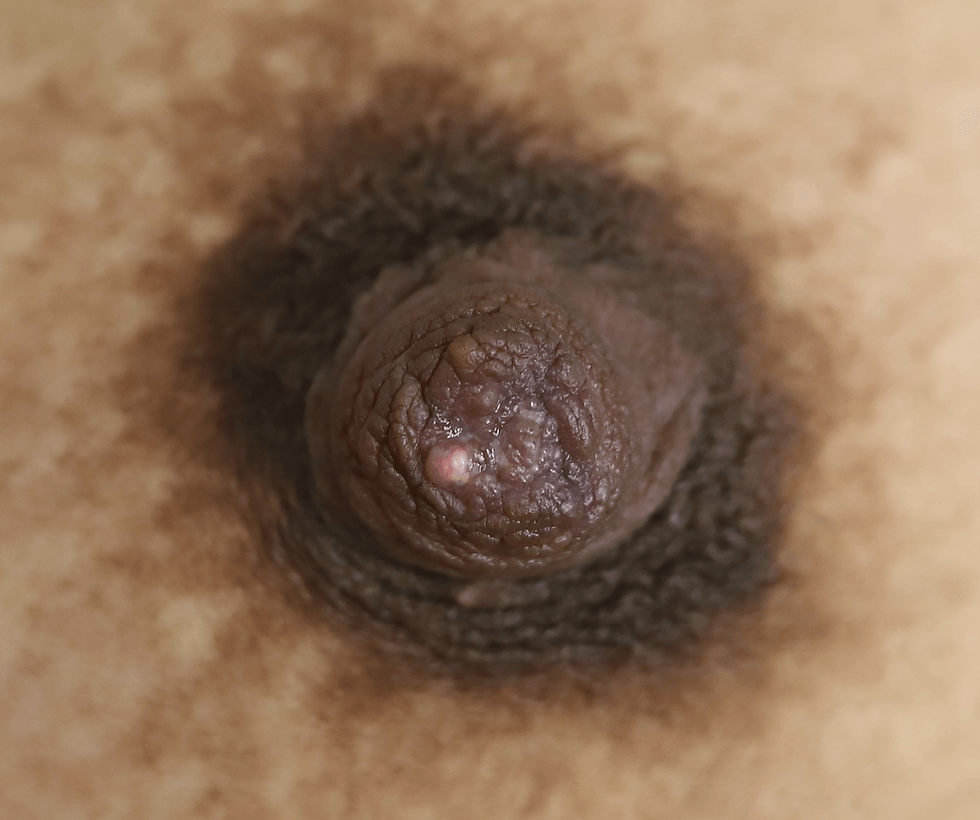 Pezon oscuro con perlita de leche.