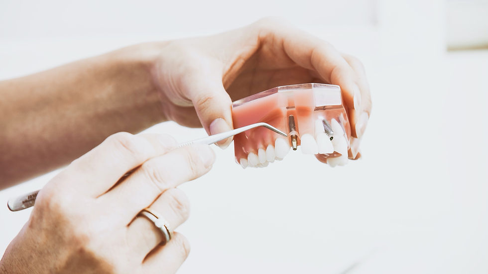 Dental implants_edited.jpg