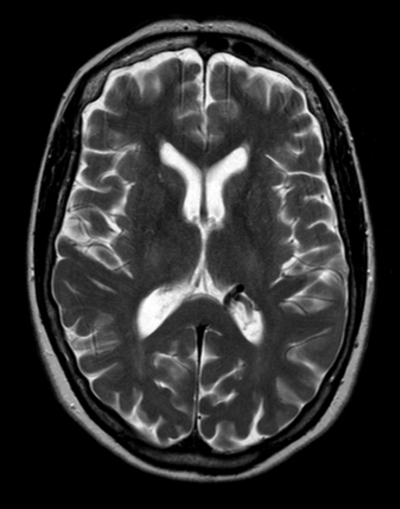 Ein MRI scan von einem Gehirn an verschidenen Positionen.
