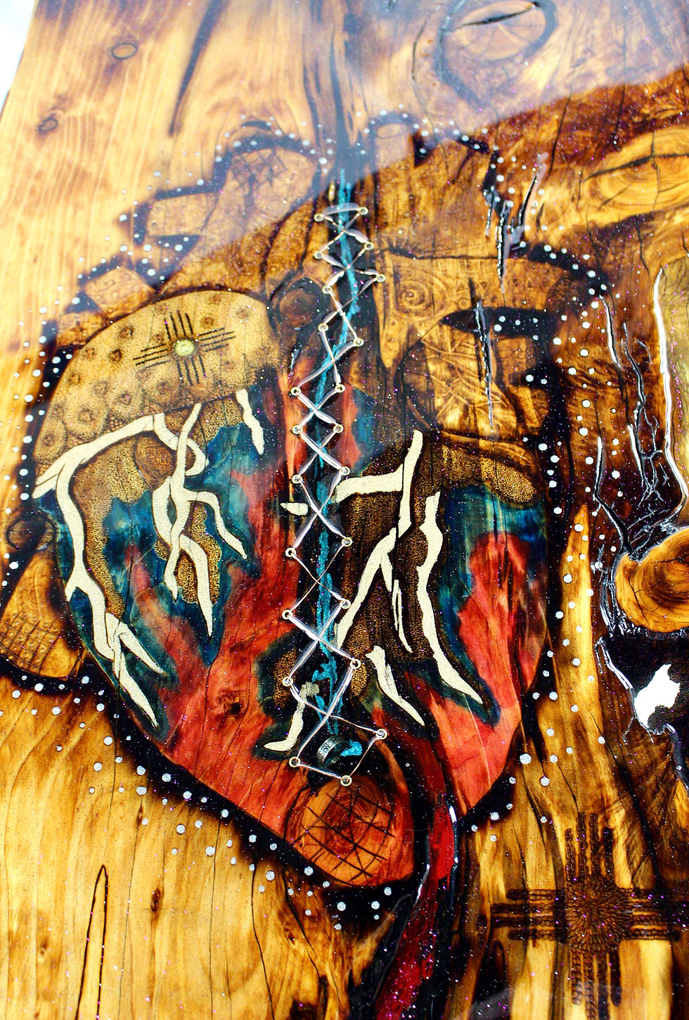 Thumbnail: "Cardiovascular Fracture" Series #03