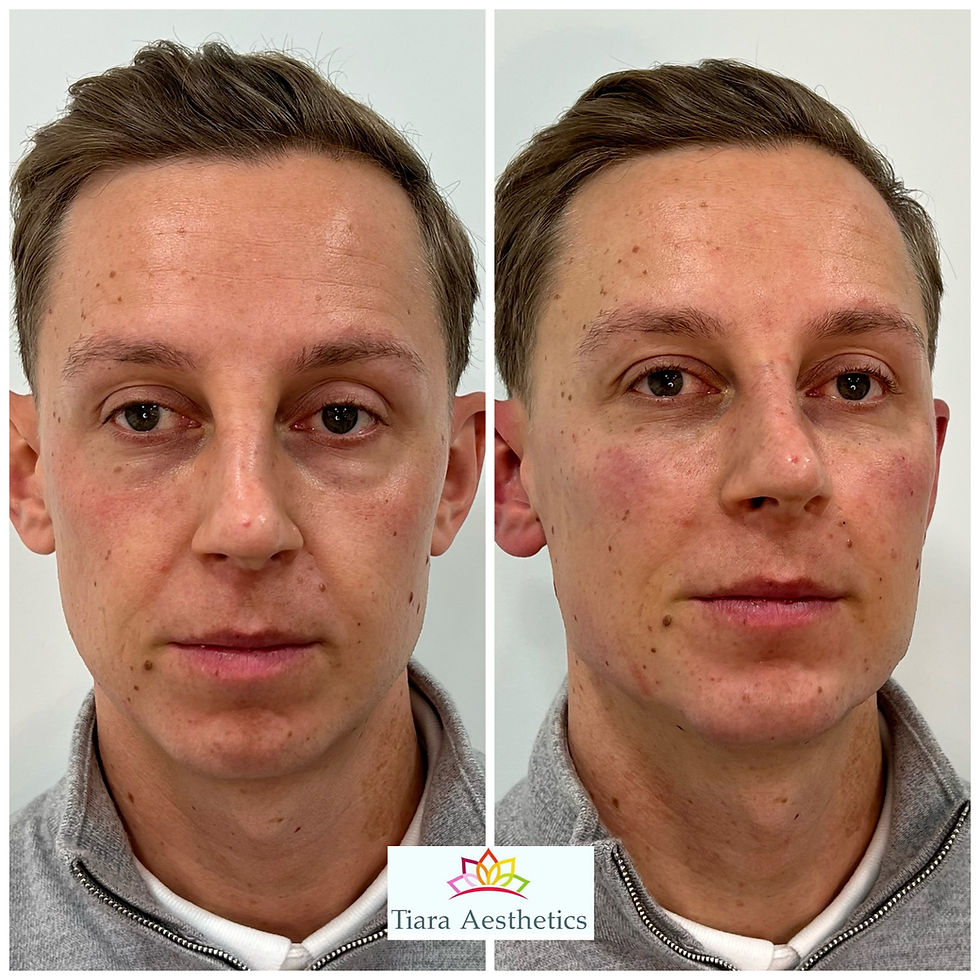Model Treatments