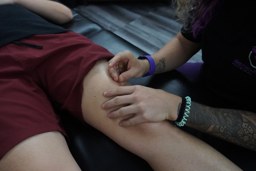 Dry Needling for spain