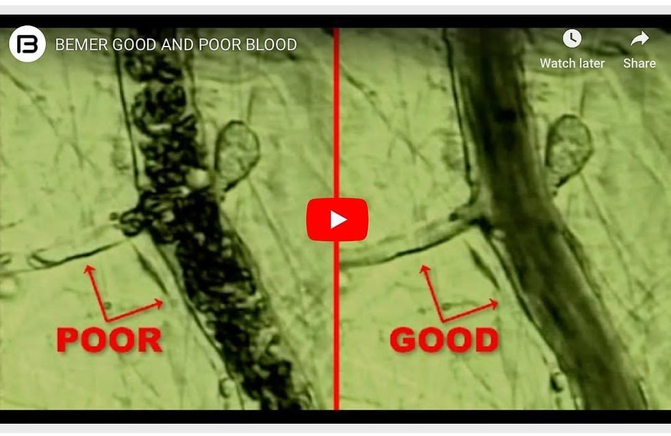 BEMER Kickoff event 2026