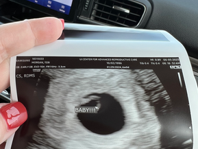 Growing Baby M: Part 1