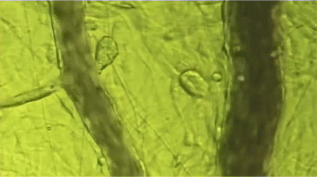 Blood flow after using BEMER