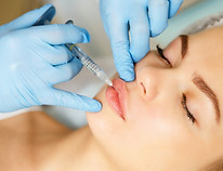 Dermal Filler | Nick Coller | Facial Aesthetics Practitioner