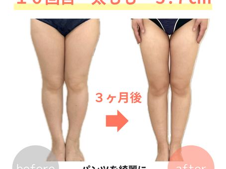 高槻で産後骨盤矯正をお探しの方へ|脂肪の癒着をゆるめて筋肉を柔らかく整える整体