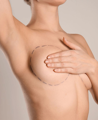 Mamoplastia.jpg