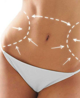 Lipoescultura.jpg
